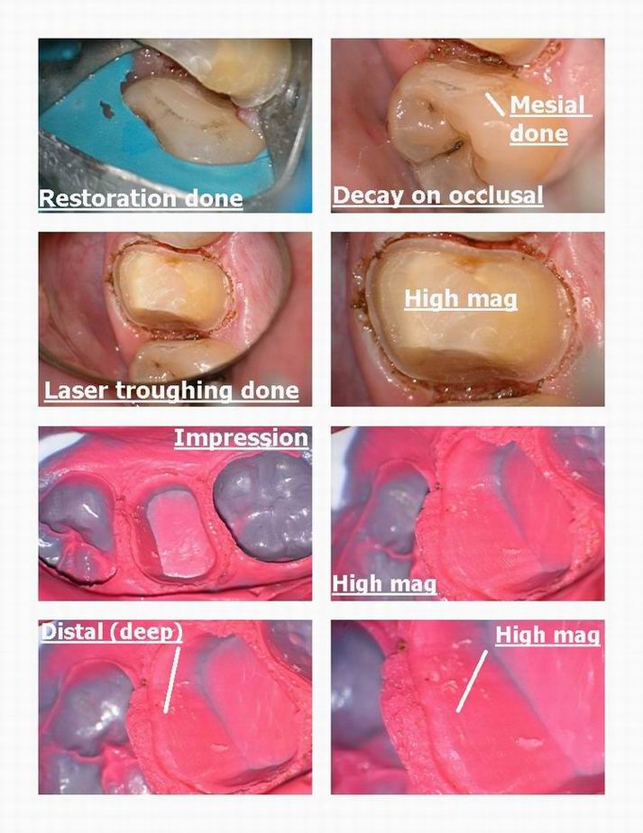 Resize of Troughing on deep distal pg 3.jpg